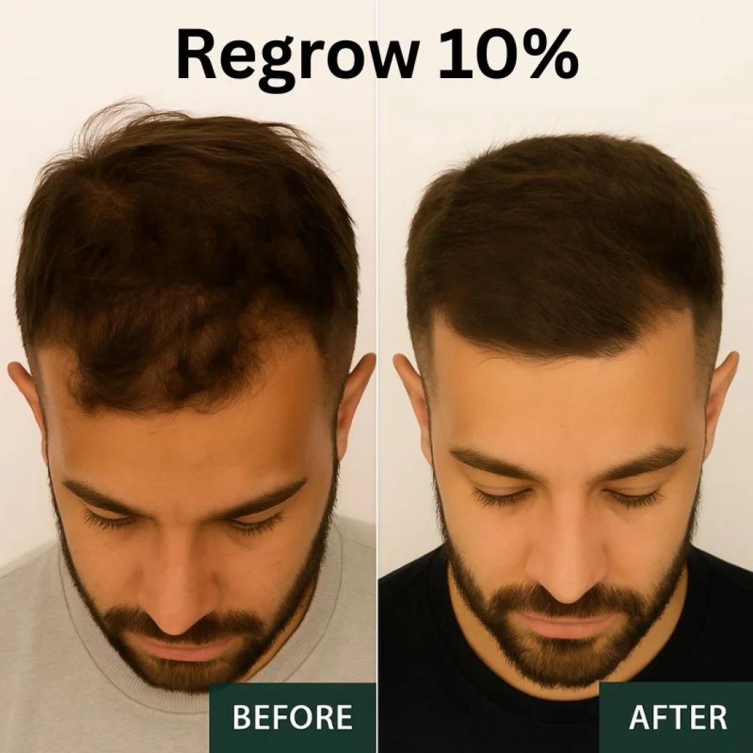 Boosts Hair Density