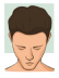 Stage 2 : Hair fall solution