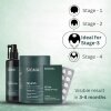 Stage 3 : Hair fall solution