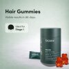 Stage 1 : Hair fall solution