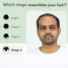 Regrow 10% â€“ Advanced Hair Regrowth Spray for Thinning Hair