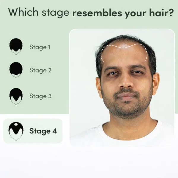 Regrow 10% â€“ Advanced Hair Regrowth Spray for Thinning Hair