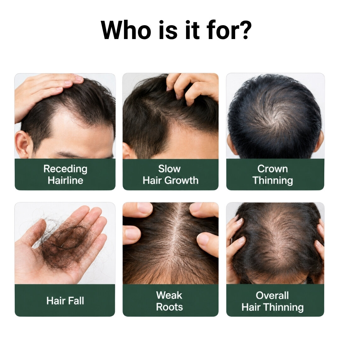 Regrow F10 Kit - Advanced Thinning