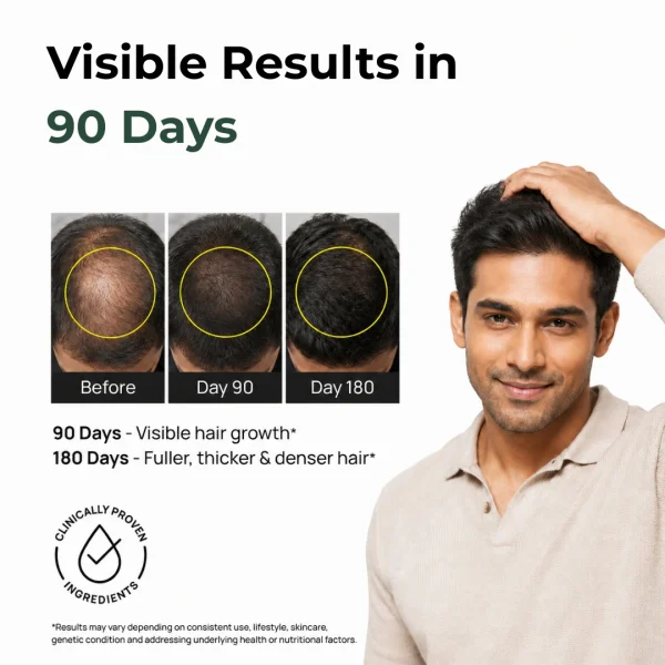 Regrow F5 Kit - Moderate Thinning