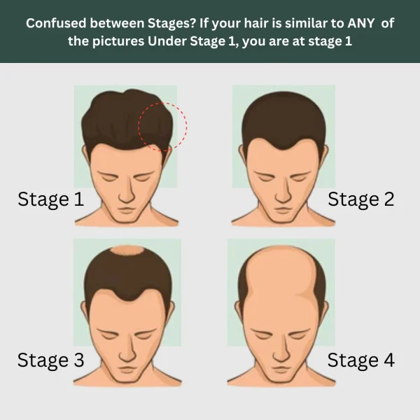 Hair Fall Stage 1: The Starter Kit