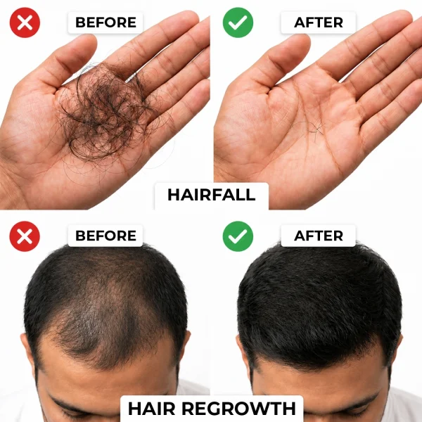 Regrow F5